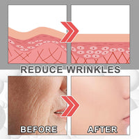 (NET) Voletas Collagen Boost Anti-Aging Serum with Hyaluronic Acid 30ml