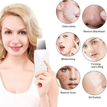(Net) Shovel Skin Machine Skin Scrubber Facial Skin Scrubber Ultrasonic Skin Scrubber Spatula, Electric Blackhead Remover KN-276