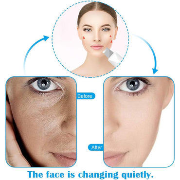 (Net) Shovel Skin Machine Skin Scrubber Facial Skin Scrubber Ultrasonic Skin Scrubber Spatula, Electric Blackhead Remover KN-276