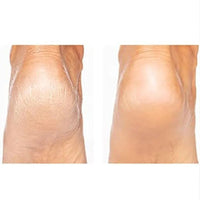 Pedicure Tool Rechargeable Dead Skin Remover, Flawless Pedi Electronic