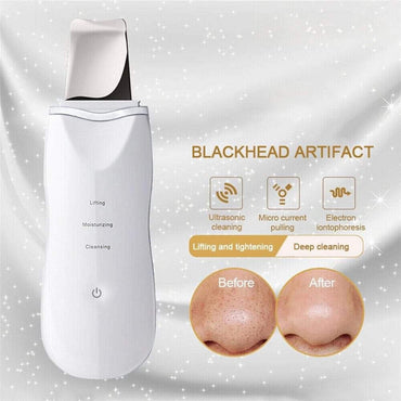 (Net) Skin Clean Machine Peeling Removes Facial Beauty Skin Scrubber / 8815