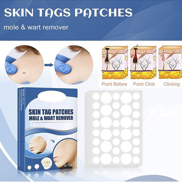 (net) Fast Skin Tag Removal Patch 144 Patches