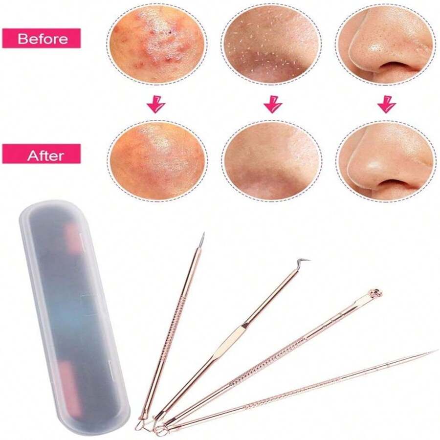 (NET) 4pcs/set Blackhead Acne Needle Skin Care Tool