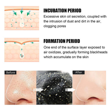 (NET)Nose Patch Pore 10 pcs