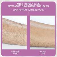 **(NET)**Crystal Epilator Armpit and Leg Hair Remover for Men and Women Painless Exfoliation Magic Hair Removal Tool