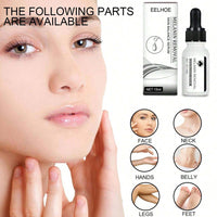 (NET)Melasma Black Point Facial Skin Care Cream 15ml