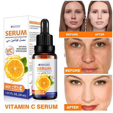 (NET) Facial Vitamin C Moisturizing Anti-Aging Firming Skin Essence 30ml/446452