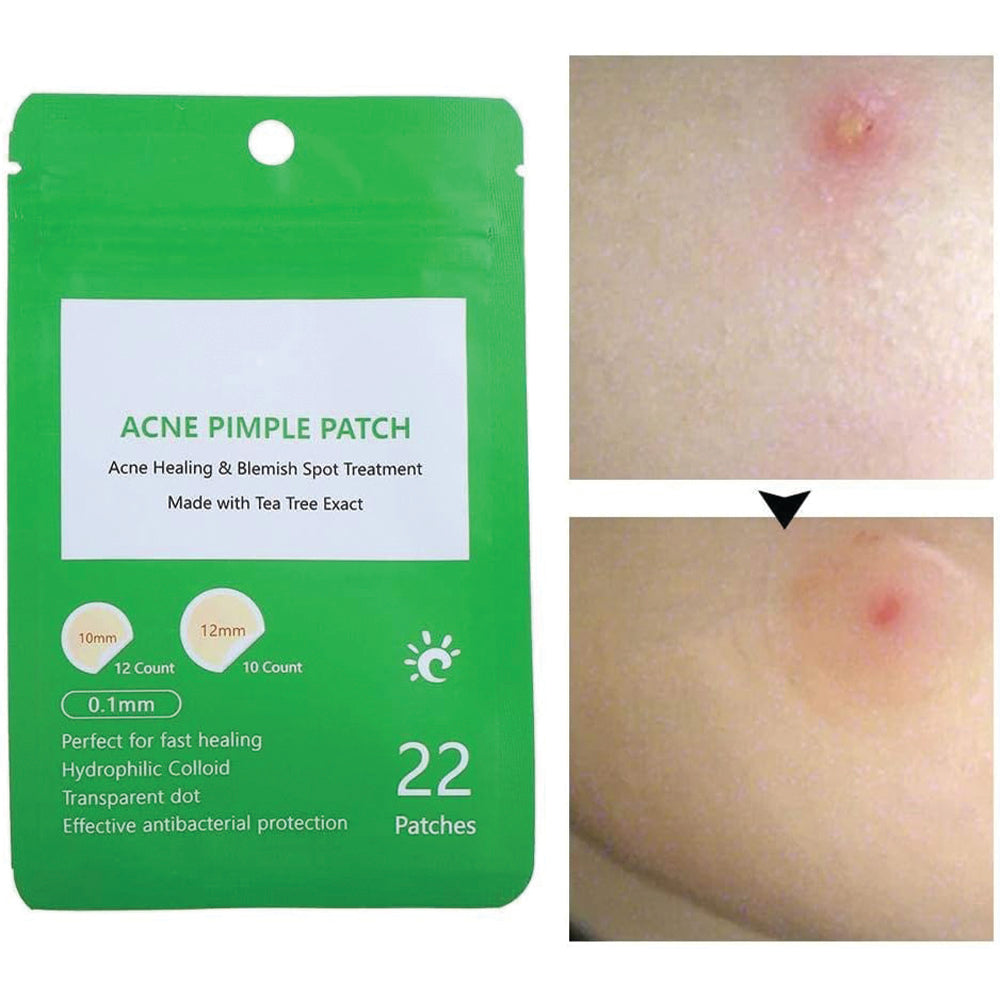 (NET) Patch Pimple Button Remove Patch Corrector, Anti Acne For Make-up 22 Patches