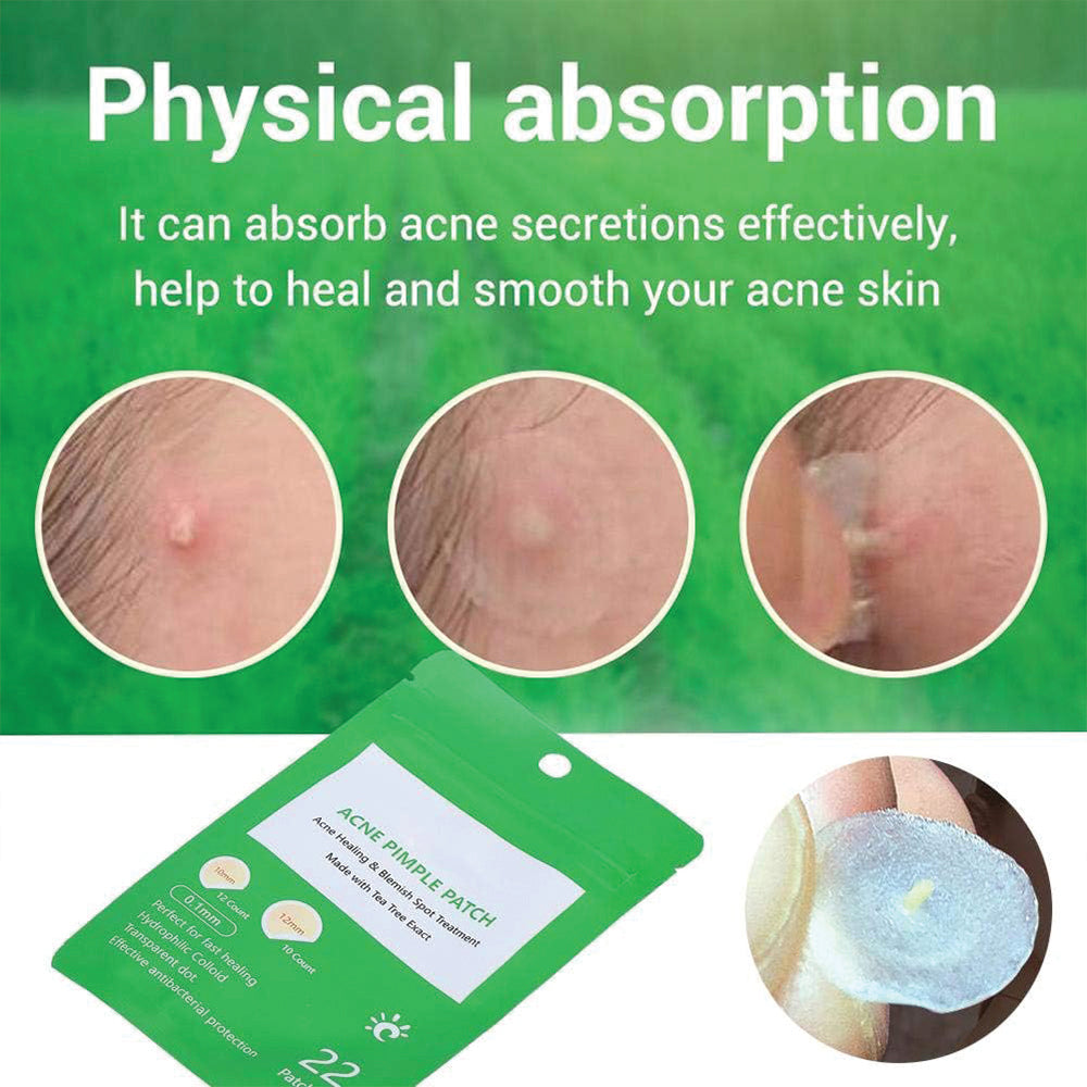 (NET) Patch Pimple Button Remove Patch Corrector, Anti Acne For Make-up 22 Patches