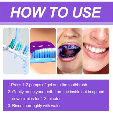 (NET) Teeth Whitening Mousse Removes Stubborn Stains 30ml