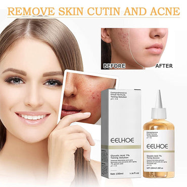 (NET)  EELHOE Glycolic Acid Toner, Face Moisturizer Toner, Glycolic Acid Toning Solution