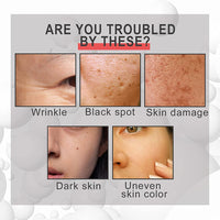 (NET) Voletas Collagen Boost Anti-Aging Serum with Hyaluronic Acid 30ml