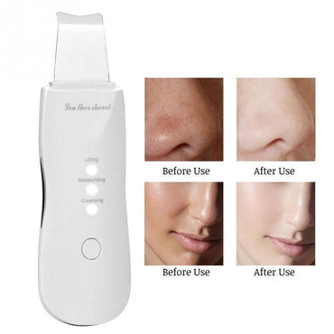 (Net) Skin Clean Machine Peeling Removes Facial Beauty Skin Scrubber / 8815