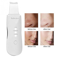 (Net) Skin Clean Machine Peeling Removes Facial Beauty Skin Scrubber / 8815