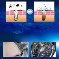 (NET) Face Mask Blackhead Remover Facial Maskdead sea mud peel off mask 120ml /214772