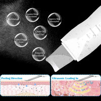 (Net) Shovel Skin Machine Skin Scrubber Facial Skin Scrubber Ultrasonic Skin Scrubber Spatula, Electric Blackhead Remover KN-276