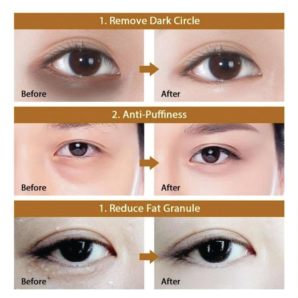 (NET) Senana MarinaUnder Eye Masks Eye Lines And Moisturizing Eye Patches/893509