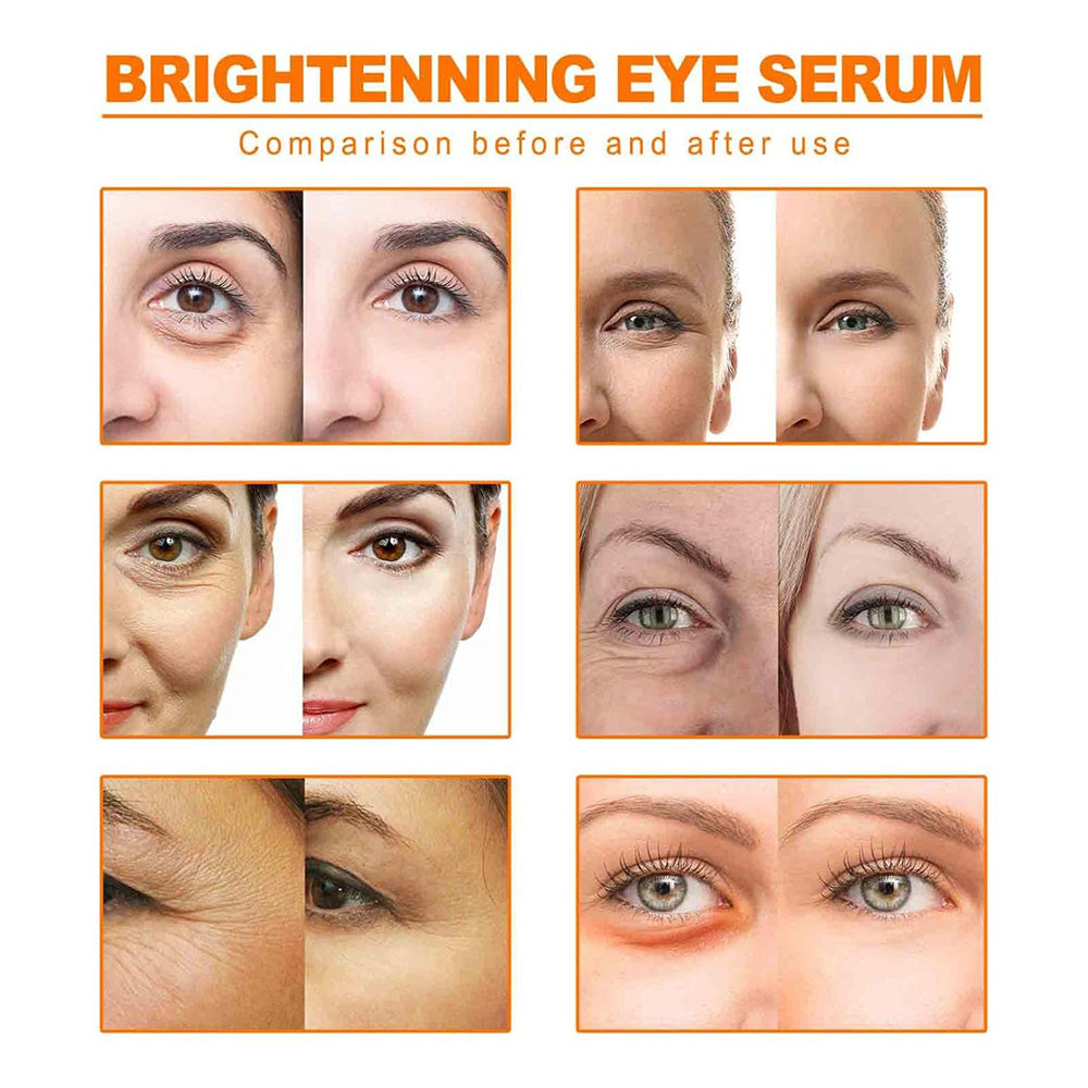 (NET)Eye Anti-Ageing Facial Serum