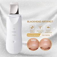 (Net) Skin Clean Machine Peeling Removes Facial Beauty Skin Scrubber / 8815