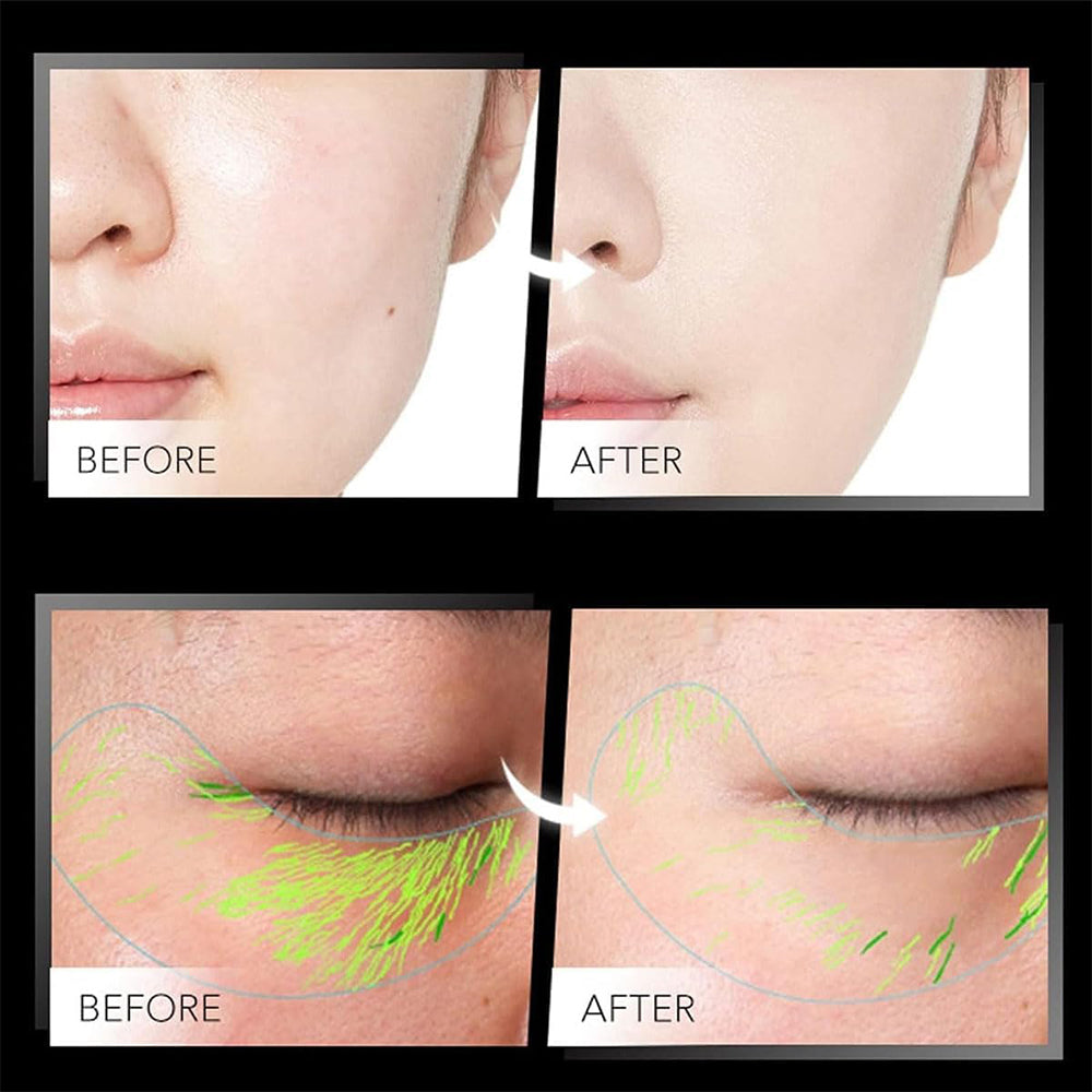 Anti-Wrinkles Face Neck Eyes Massager