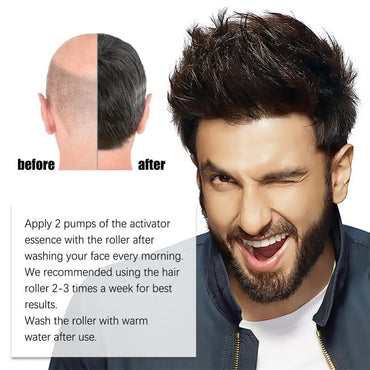 (NET) Men Hair Beard Growth Derma Roller Hair Loss Treatment