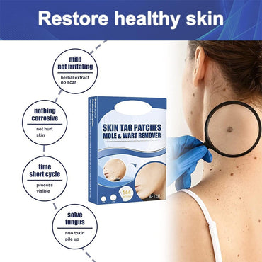 (net) Fast Skin Tag Removal Patch 144 Patches
