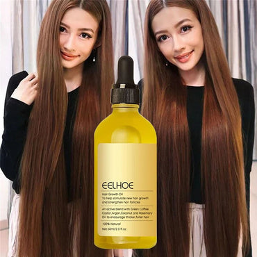 (NET) Hair Growth Products Prevent Hair Loss Essential Oil Fast Growing Anti-Drying Scalp Treatment 60 ML