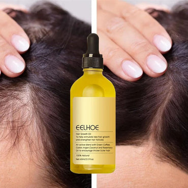 (NET) Hair Growth Products Prevent Hair Loss Essential Oil Fast Growing Anti-Drying Scalp Treatment 60 ML