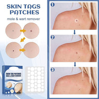 (net) Fast Skin Tag Removal Patch 144 Patches