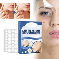 (net) Fast Skin Tag Removal Patch 144 Patches