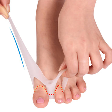 1 Pair Toe Corrector  Valgus Bunion Corrector