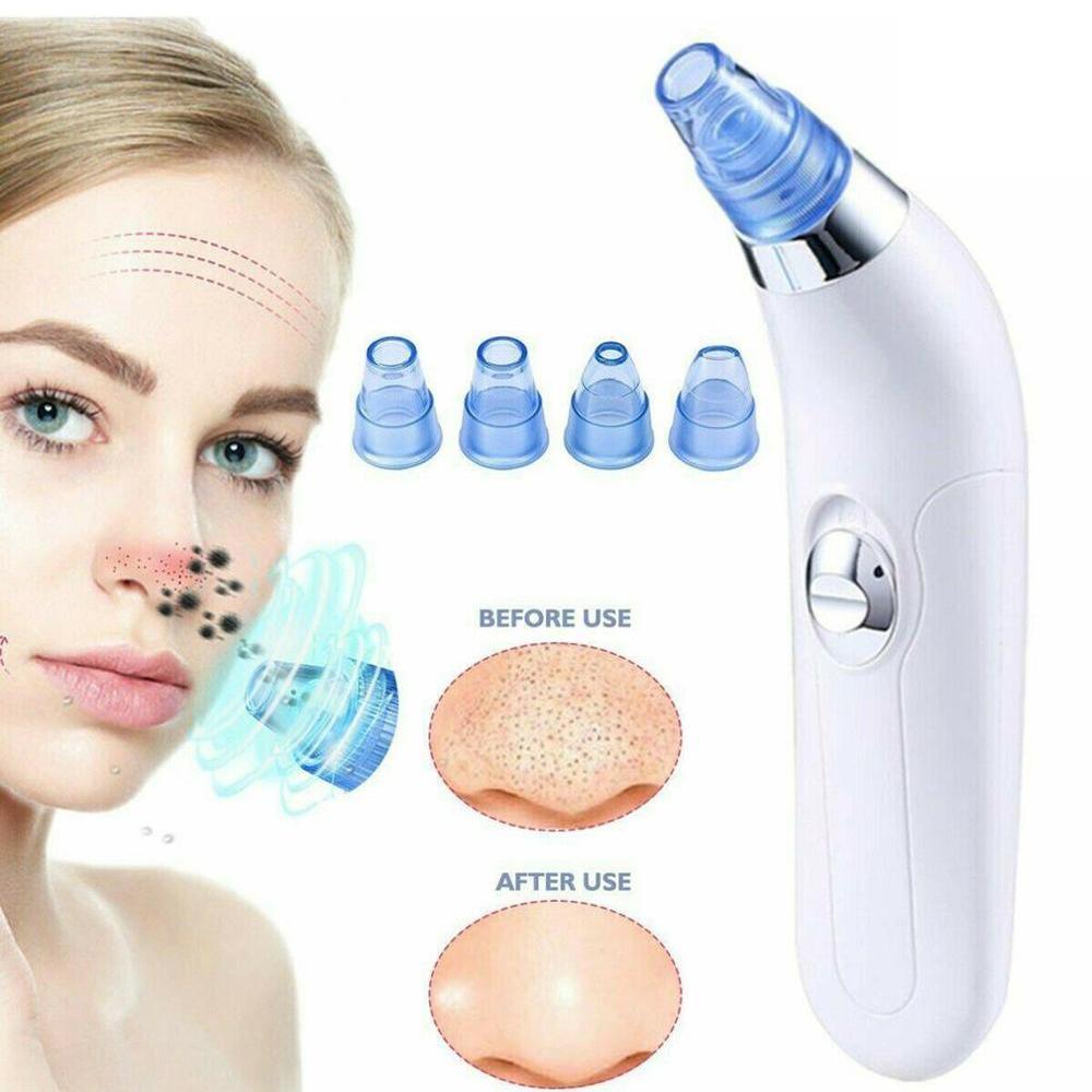 Derma Suction Pore Cleaning Device Blackhead Remover – Acne Pimple Pore Cleaner Vacuum Suction Tool For Men And Women - Karout Online